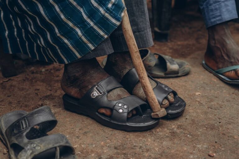 Chaussures adaptées senior pieds gonflés : guide d'achat 2026 - Close-up of feet in sandals with a walking cane, embodying cultural attire and lifestyle.